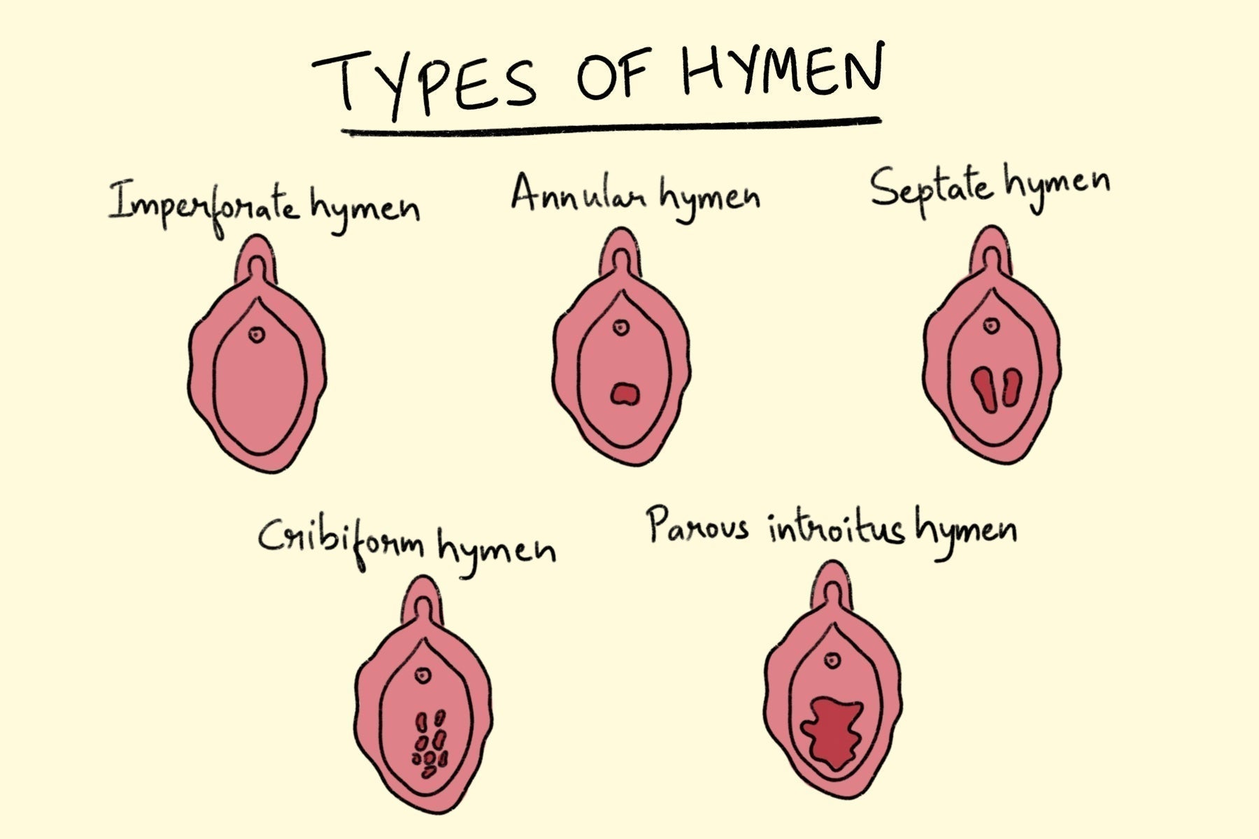 Busted: The Virginity Myth That Just Won’t Die